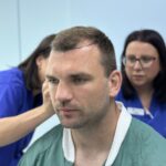 Tadhg Beirne hair transplant